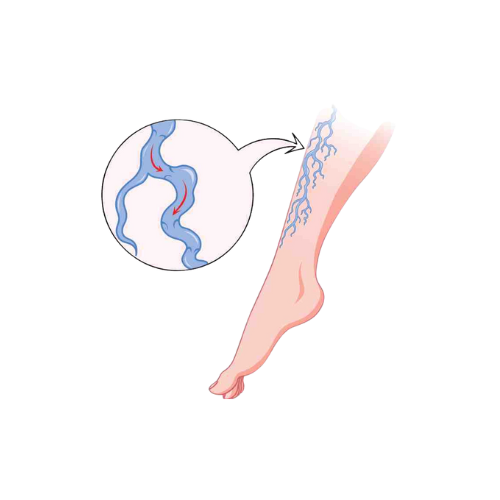 Reduce Presión Vascular