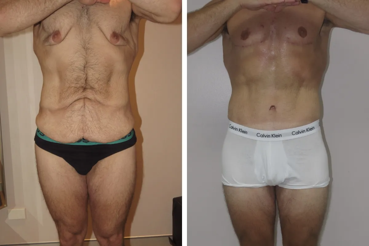 Rezultat Miloš Jovanović