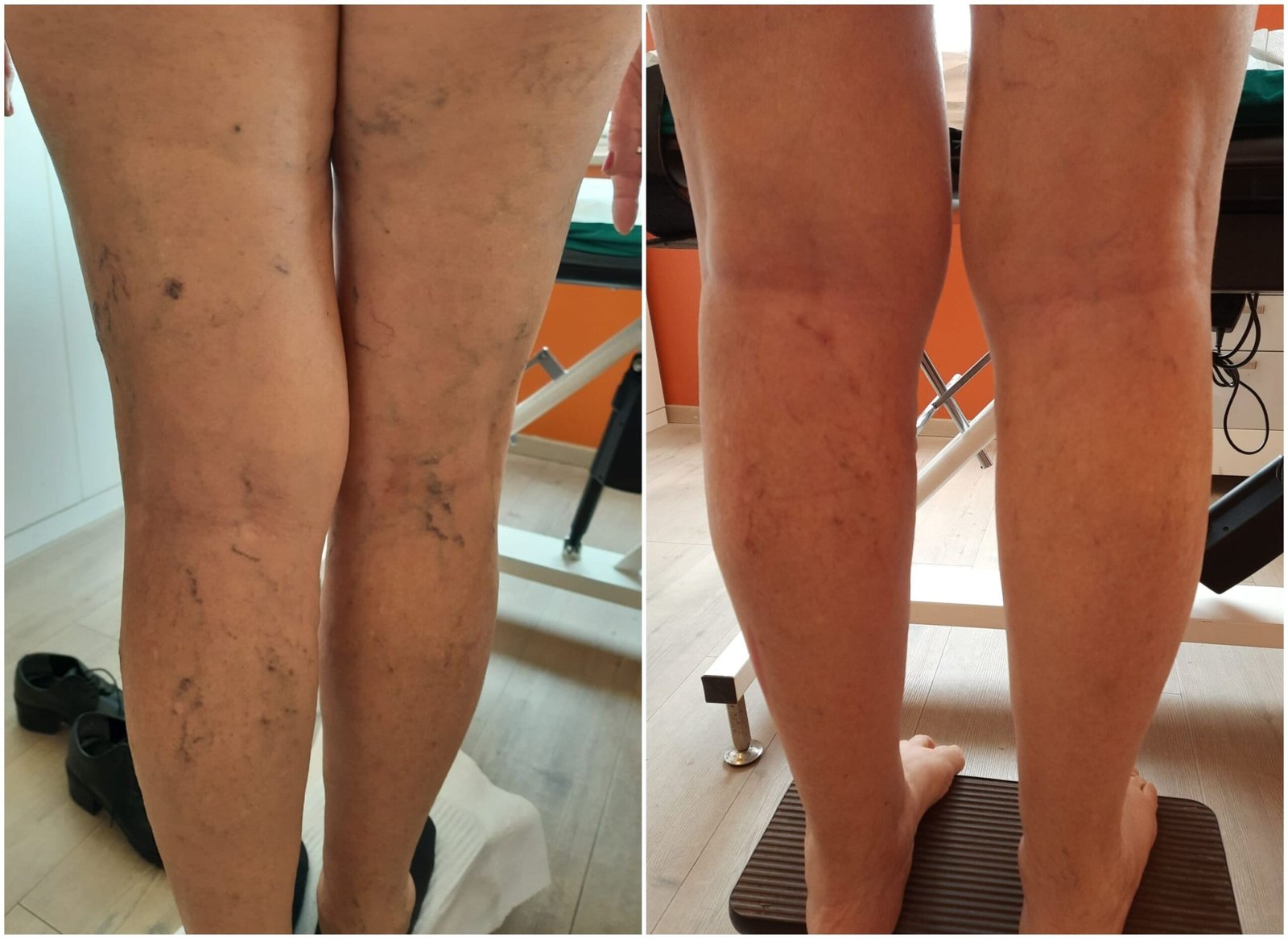 Resultado Ana López