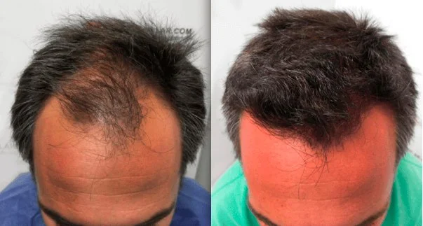 Resultado Roberto Mendoza