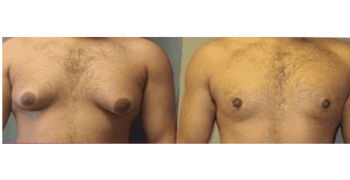 Rezultat Dragan Stojanović