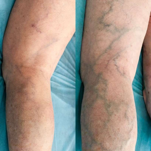 Resultado José Martínez