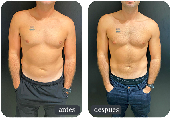 Rezultat Nemanja Milić