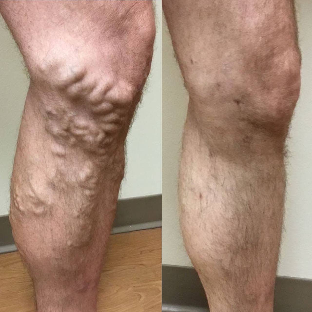 Resultado Roberto Mendoza