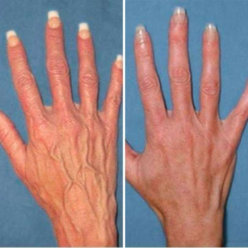 Resultado Lucía García