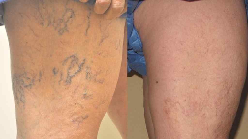 Resultado Carlos Rodríguez