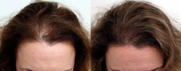 Resultado Ana López