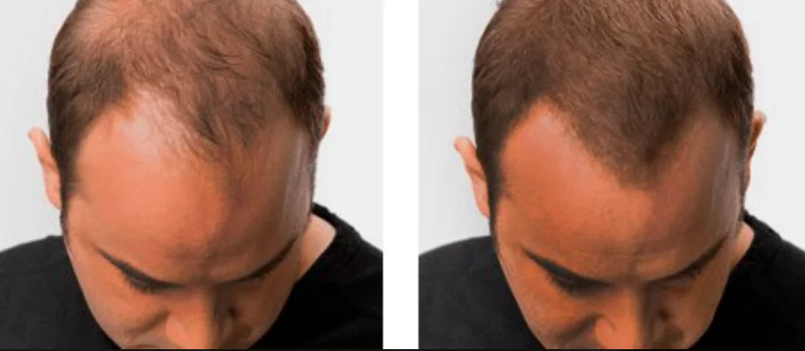 Resultado Carlos Rodríguez