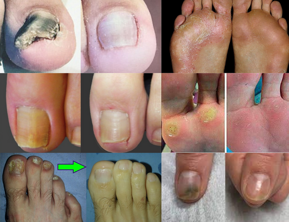 Penetra Profundamente