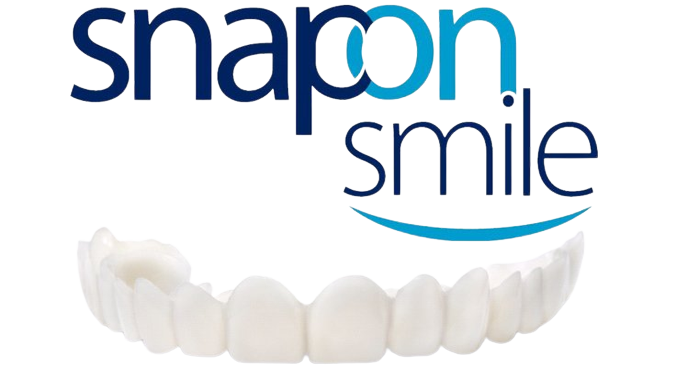 Snap On Smile Facetas