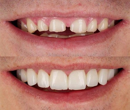 Antes e depois cliente 3